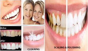 teeth cleaning in delhi, best dentist in delhi, best dentist in south delhi