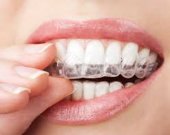 Teeth whitening In Delhi, zoom teeth whitening in delhi