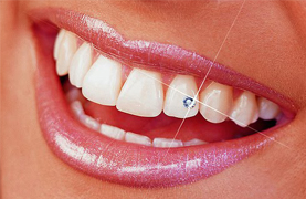 Cosmetic Dentistry India, Teeth Jewellery In Delhi Cosmetic Dentistry India, Teeth Jewellery In Delhi