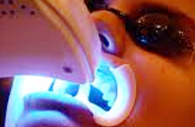 Laser Dentistry