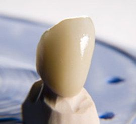 CAD-CAM based crowns, veneers, inlays – onlays to your clinic in 4 hour’s time CAD-CAM based crowns, veneers, inlays – onlays to your clinic in 4 hour’s time