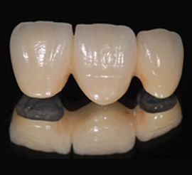 Dental Laboratory in Delhi, Dental Lab in delhi Dental Laboratory in Delhi, Dental Lab in delhi